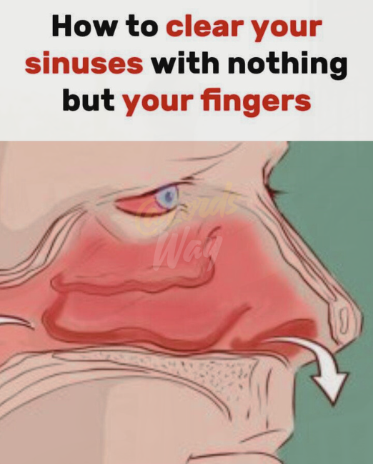 Doctors Won’t Tell You This Sinus Trick – Try It Before Your Next Spray! 1