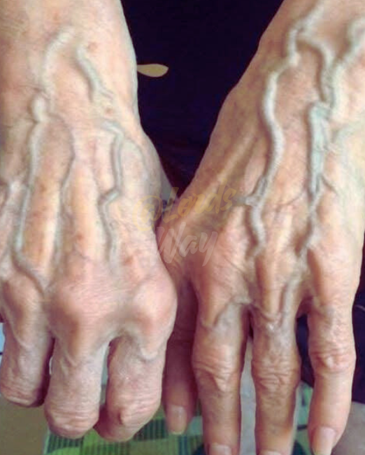 If You Can See Your Hand Veins Clearly, Read This First 11