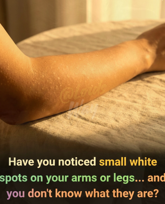 The Hidden Reason Behind Those Small White Spots on Your Skin 14
