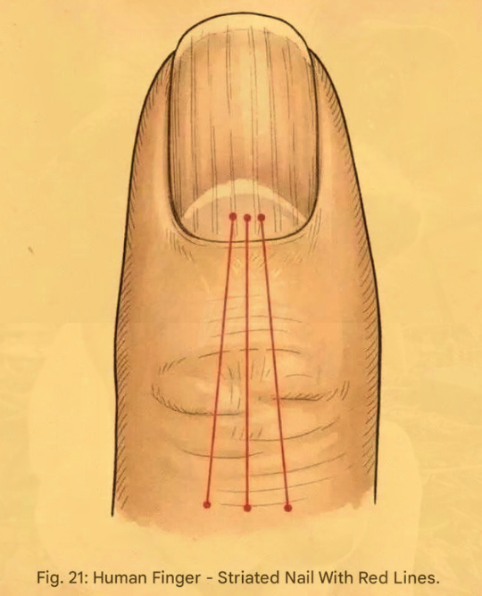 Do Lines on Your Nails Really Mean Cancer? 18