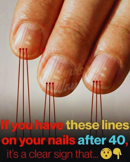If You’re Over 40 and See These Nail Lines, Read This First 3