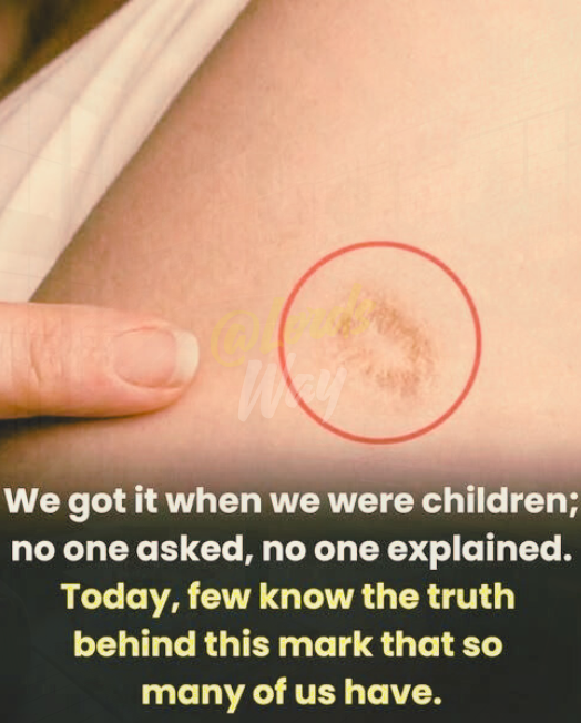 The Scar I Couldn’t Stop Staring At 3