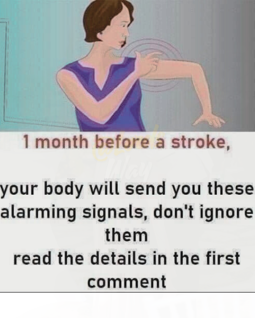 Doctors Warn: These Subtle Signs Could Mean a Stroke Is Coming 3