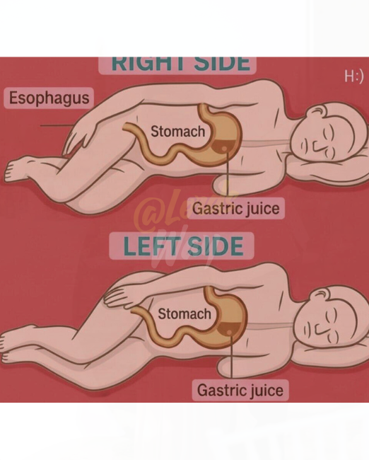 Doctors Say Avoid Sleeping on Your Right Side — Here’s Why 6