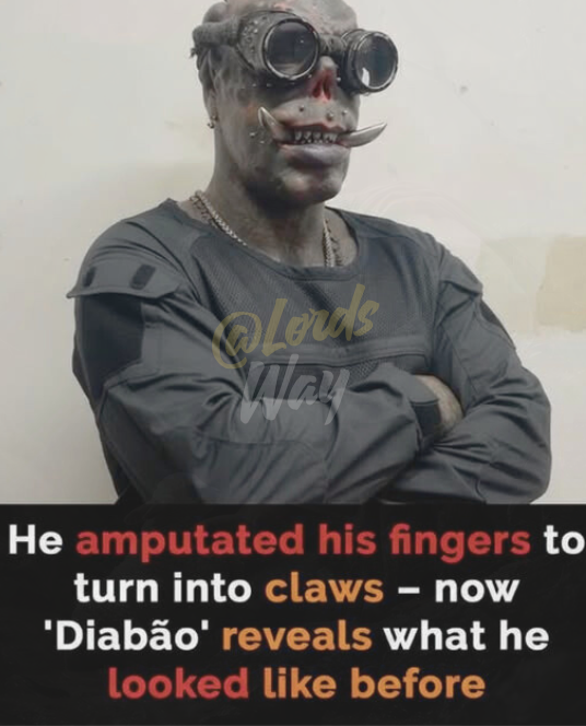 He Removed His Own Fingers — But Wait Until You See His Before Photo 8