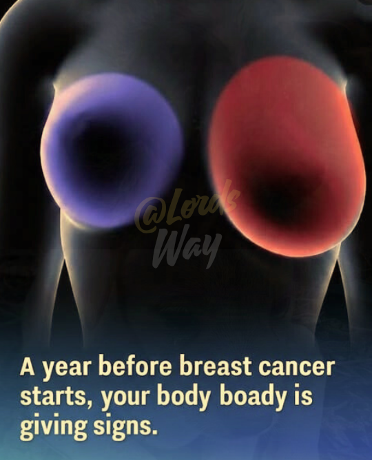 4 Early Breast Cancer Signs Every Woman Should Never Ignore 8