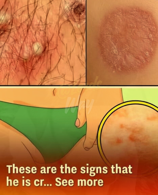 The Silent Signs in His Feet You Shouldn’t Ignore 9