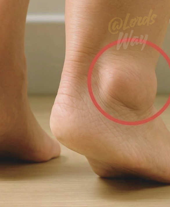 Swollen Feet Could Be a Warning Sign… Not Just Aging 10