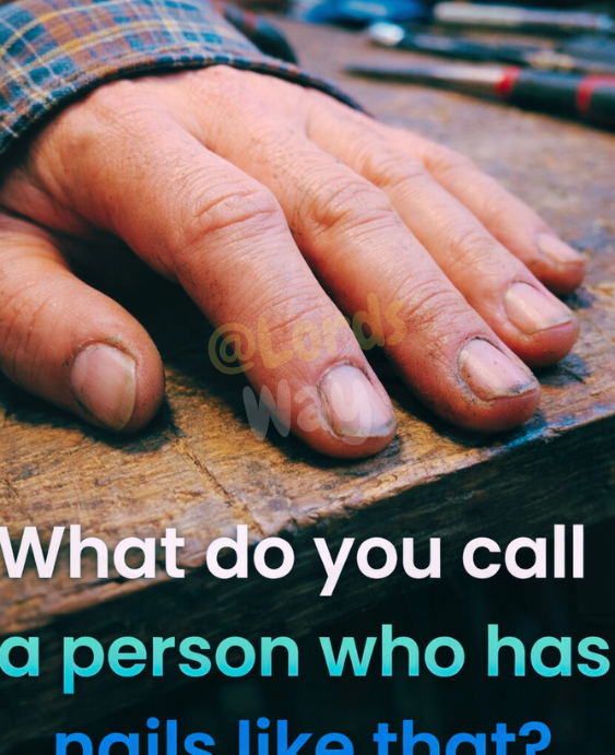 The Truth About Dirt Under Someone’s Fingernails 2