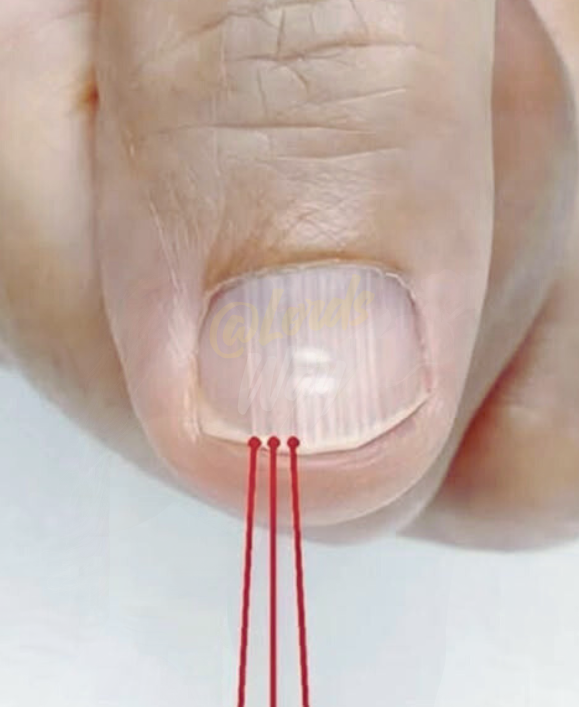 The Nail Lines Doctors Say You Should Never Ignore After 40 3