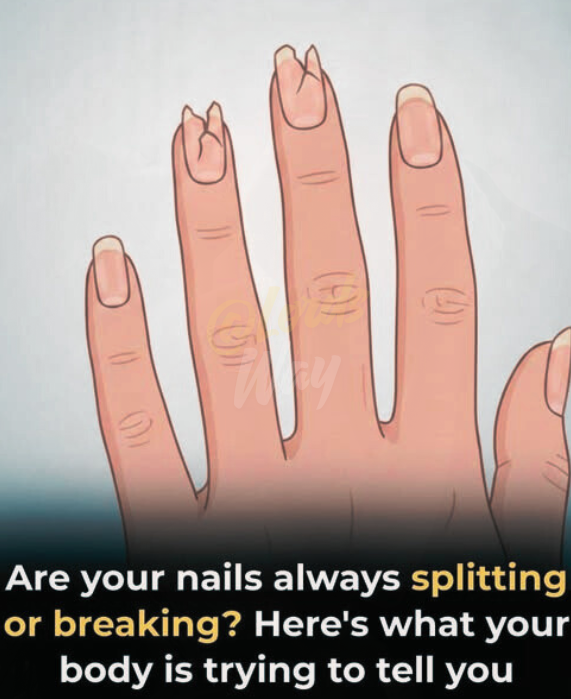 7 Nail Changes Doctors Say Could Reveal Hidden Health Problems 3