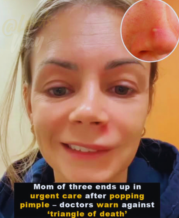 The “Danger Zone” on Your Face… And Why You Should Never Touch It 7