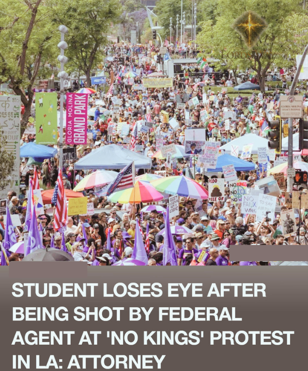 Shot While Filming: The Protest Moment That Cost Him His Eye 5