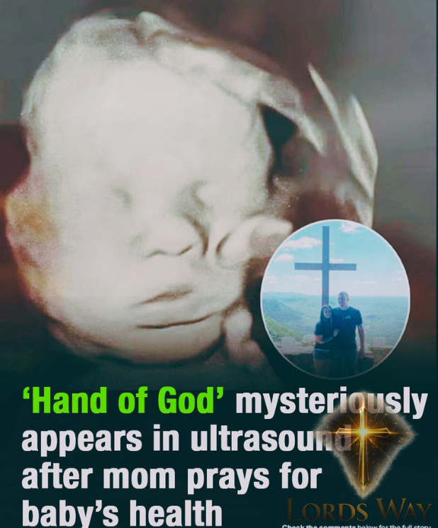 The Ultrasound Image That Left Everyone Speechless 8